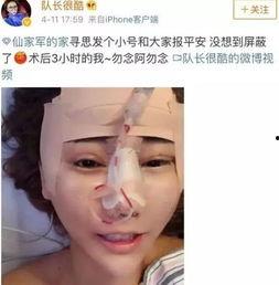 整形手术爆料视频大全,爆料视频大全深度解析 第1张 整形手术爆料视频大全,爆料视频大全深度解析 第1张